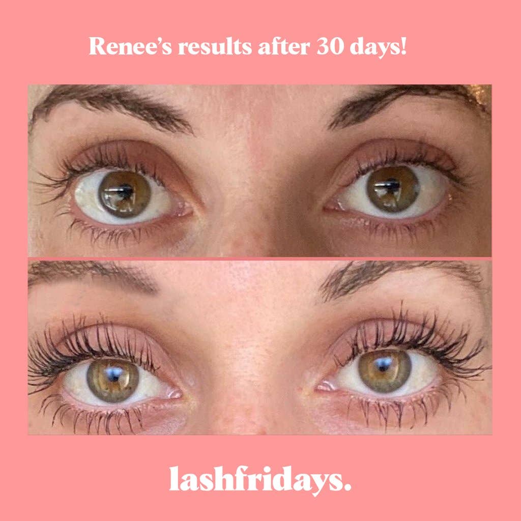 Eyelash Growth Serum